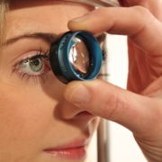 glaucoma secondario, una medico usa una lente di ingrandimento per guardare con attenzione l'occhio di una donna