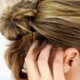 una donna si gratta la testa irritando un neo sul cuoio capelluto