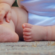 malattia genetica rara, inquadratura dei piedini di un bimbo seduto