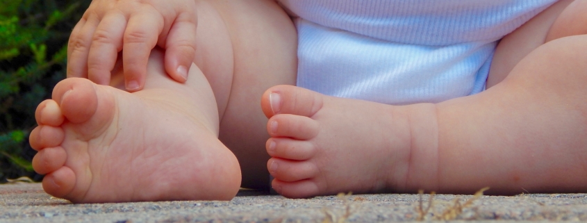 malattia genetica rara, inquadratura dei piedini di un bimbo seduto
