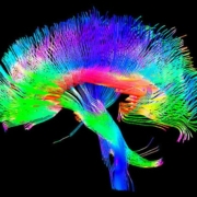 elon musk neuroscienze, l'immagine di un cervello ripresa da una tac