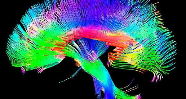 elon musk neuroscienze, l'immagine di un cervello ripresa da una tac