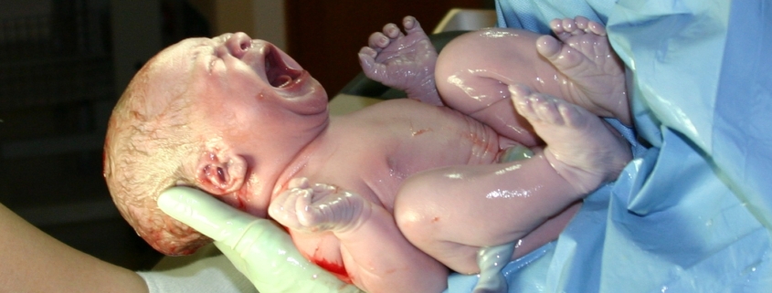 intervento, un bimbo appena nato