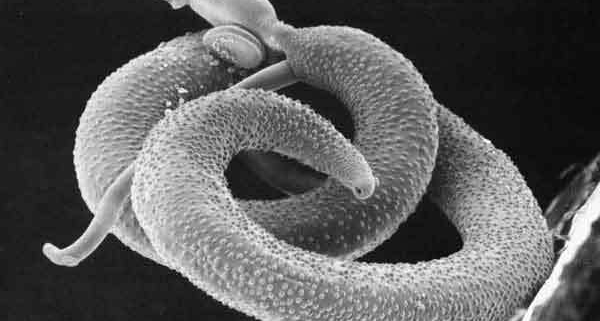 il parassita della schistosomiasi