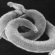 il parassita della schistosomiasi