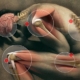 fibromialgia, un'immagine modificata in grafica mostra le articolazioni di un uomo in posizione rannicchiata