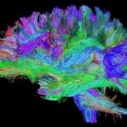 mielina, un immagine del cervello