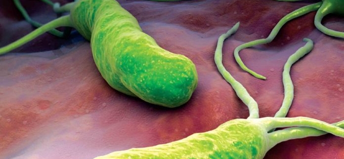gli helicobacter pylori possono causare il tumore