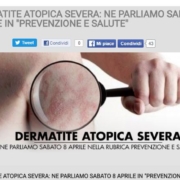 dermatite atopica severa, la locandina del portale di radio kiss kiss italia