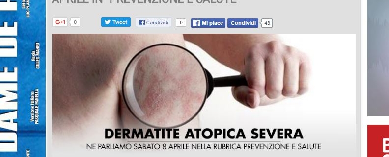 dermatite atopica severa, la locandina del portale di radio kiss kiss italia