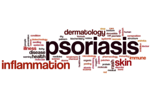 psoriasi