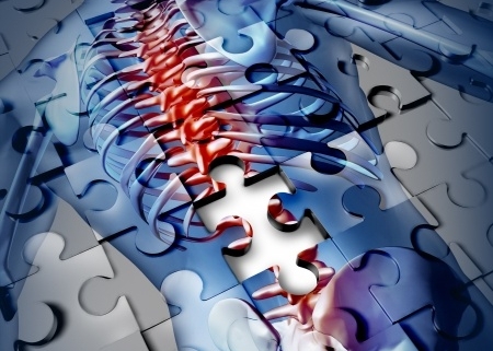 osteoporosi, il corpo di una donna rappresentato in un puzzle