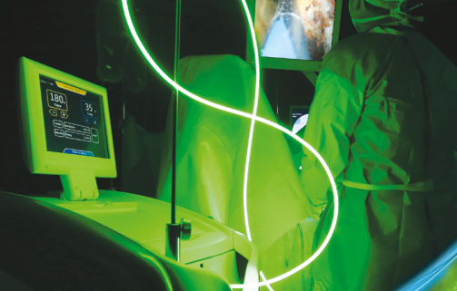 prostata, intervento con il laser verde