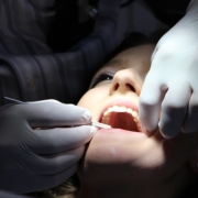 protesi dentali, una nuova tecnica