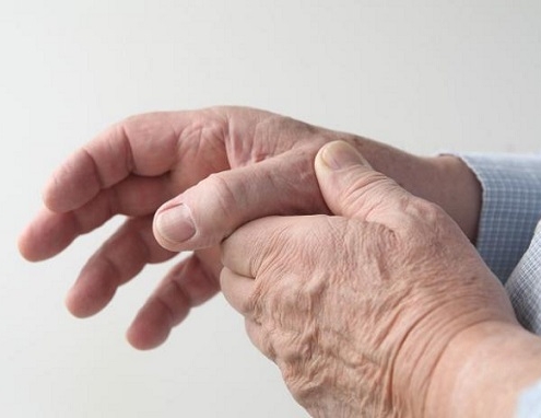 sviluppo diagnosi e trattamento dell artrite reumatoide preview default 2