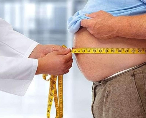 obesità , medico misura a un paziente la circonferenza dello stomaco
