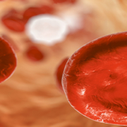 tumori del sangue. sindromi-mielodisplastiche