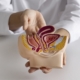fegato grasso: le mani di un medico mostrano un modello del fegato