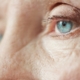 degenerazione maculare, occhio azzurro di un anziano in primo piano visto di profilo