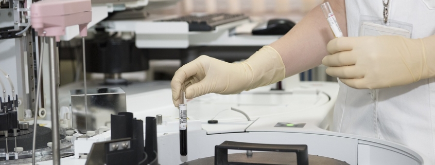 malattia di chagas, un laboratorio di analisi