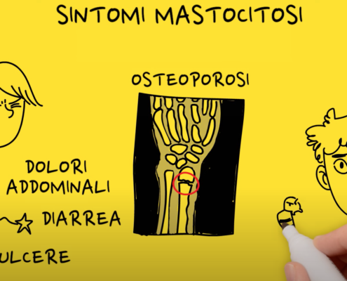 mastocitosi, la campagna