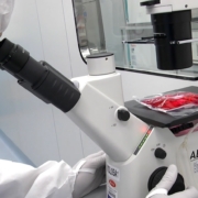 malattie reumatologiche, un ricercatore lavora su cellule car-t
