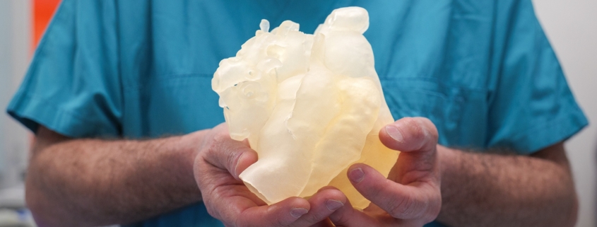 protesi 3d per asaad, 8 anni di gaza torna a camminare 9 utf 8stampa 3d cuore univentricolare simulazione procedura