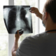boco un medico guarda una radiografia al torace