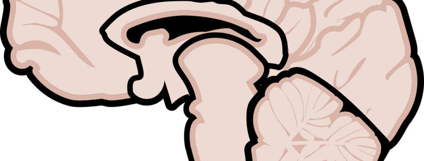 graphic, human brain, brain, brain diagram, neurology, medicine, mri, multiple sclerosis, ms, graphics, mind, human, knowledge, thinking, intelligence, human brain, brain, brain, brain, brain, brain, brain diagram, brain diagram, brain diagram, neurology, mri, mri, mri, multiple sclerosis, multiple sclerosis, multiple sclerosis, multiple sclerosis