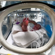 la terapia intensiva neonatale del monaldi