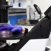 analisi campione al microscopio pe rindividuare molecola di malattia di still