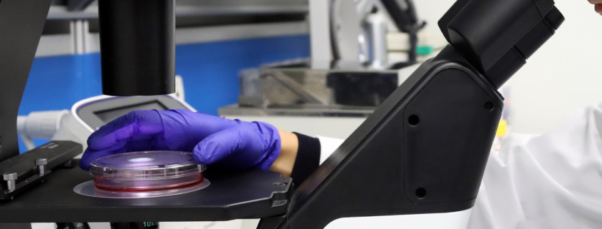 analisi campione al microscopio pe rindividuare molecola di malattia di still