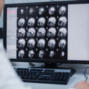 meningite, una risonanza al cervello