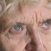 degenerazione maculare, una donna anziana