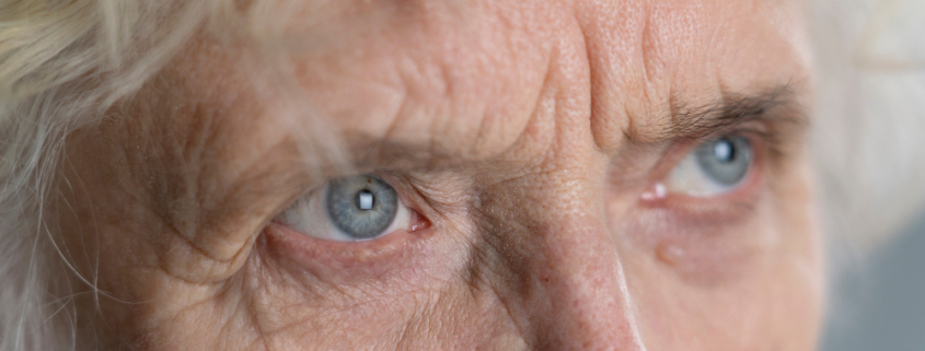 degenerazione maculare, una donna anziana