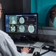 chip impiantato nel cervello