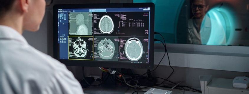 chip impiantato nel cervello