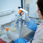 beta-talassemia, il laboratorio terapia genica