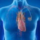 pacemaker