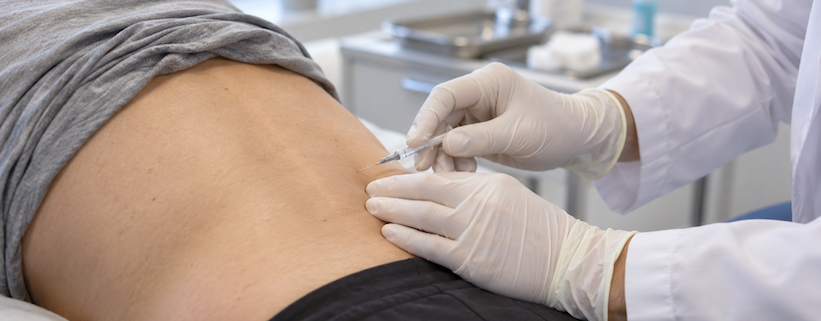 mesoterapia antalgica: che cos’è e quando si usa 1 mesoterapia antalgica
