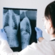 mesotelioma