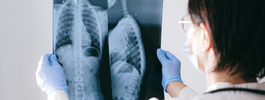 mesotelioma: fare rete per migliorare le cure 1 mesotelioma
